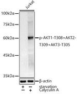 Phospho-AKT1 (Thr308) Antibody in Western Blot (WB)