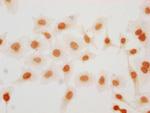 2-hydroxyisobutyryl-HIST1H2BC (Lys57) Polyclonal Antibody