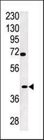 TPST2 Polyclonal Antibody