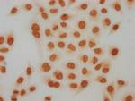 H4K91ac Polyclonal Antibody