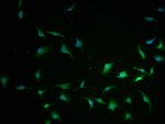 CCHCR1 Polyclonal Antibody