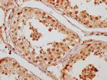CCHCR1 Antibody in Immunohistochemistry (Paraffin) (IHC (P))