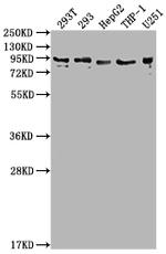 CCHCR1 Antibody in Western Blot (WB)