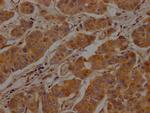 Clathrin Heavy Chain Polyclonal Antibody