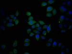 Epiregulin Polyclonal Antibody