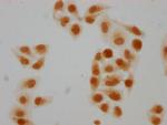 Formyl-HIST1H2BC (Lys108) Polyclonal Antibody