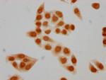 Formyl-HIST1H2BC (Lys5) Polyclonal Antibody