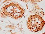 Histone H2A.X Antibody in Immunohistochemistry (Paraffin) (IHC (P))