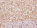HS3ST3B1 Polyclonal Antibody