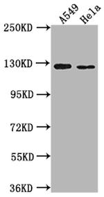 IGSF3 Polyclonal Antibody
