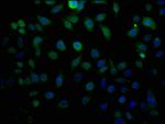 LTC4S Polyclonal Antibody