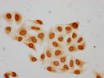 Mono-Methyl-HIST1H2BC (Lys15) Polyclonal Antibody