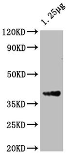 ompF Polyclonal Antibody