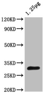 Trehalose-6-phosphate phosphatase Polyclonal Antibody