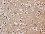 PCDHA8 Antibody in Immunohistochemistry (Paraffin) (IHC (P))