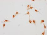 Phospho-Histone H1.5 (Ser17) Antibody in Immunocytochemistry (ICC/IF)