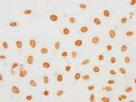 Phospho-Histone H1.5 (Ser188) Antibody in Immunocytochemistry (ICC/IF)