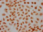 Phospho-Histone H3 (Tyr41) Antibody in Immunocytochemistry (ICC/IF)