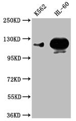 POTEE Polyclonal Antibody