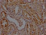 RHBDF2 Polyclonal Antibody
