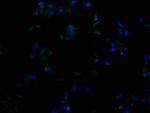 RHBDF2 Polyclonal Antibody