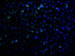 RHBDF2 Polyclonal Antibody