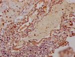 RNF122 Antibody in Immunohistochemistry (Paraffin) (IHC (P))