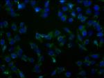 SLC23A2 Polyclonal Antibody
