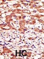 MGAT1 Polyclonal Antibody