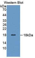Profilin 3 Antibody in Western Blot (WB)