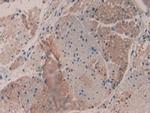MYH16 Antibody in Immunohistochemistry (Paraffin) (IHC (P))