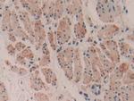 MYH16 Polyclonal Antibody