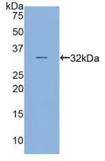 MYH16 Antibody in Western Blot (WB)