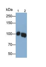 MYH16 Antibody in Western Blot (WB)