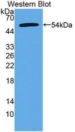 CTRB2 Antibody in Western Blot (WB)