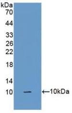 SFTA2 Polyclonal Antibody