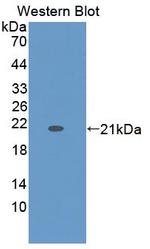 ZG16B Antibody in Western Blot (WB)