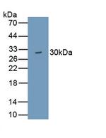 WDR90 Polyclonal Antibody