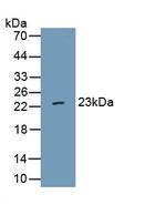VWA5B2 Polyclonal Antibody