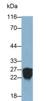 Trypsin 2 Antibody in Western Blot (WB)