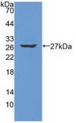 Trypsin 2 Antibody in Western Blot (WB)