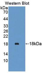 TRAPPC2 Polyclonal Antibody