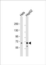 Ribophorin I Polyclonal Antibody
