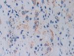 TOP3A Polyclonal Antibody