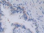 TOP3A Antibody in Immunohistochemistry (Paraffin) (IHC (P))