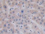 TOP3A Antibody in Immunohistochemistry (Paraffin) (IHC (P))