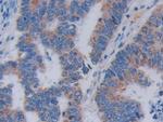 TOP3A Antibody in Immunohistochemistry (Paraffin) (IHC (P))