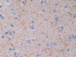 TOP3A Antibody in Immunohistochemistry (Paraffin) (IHC (P))