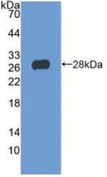 TIGIT Antibody in Western Blot (WB)
