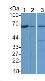 TESK1 Antibody in Western Blot (WB)